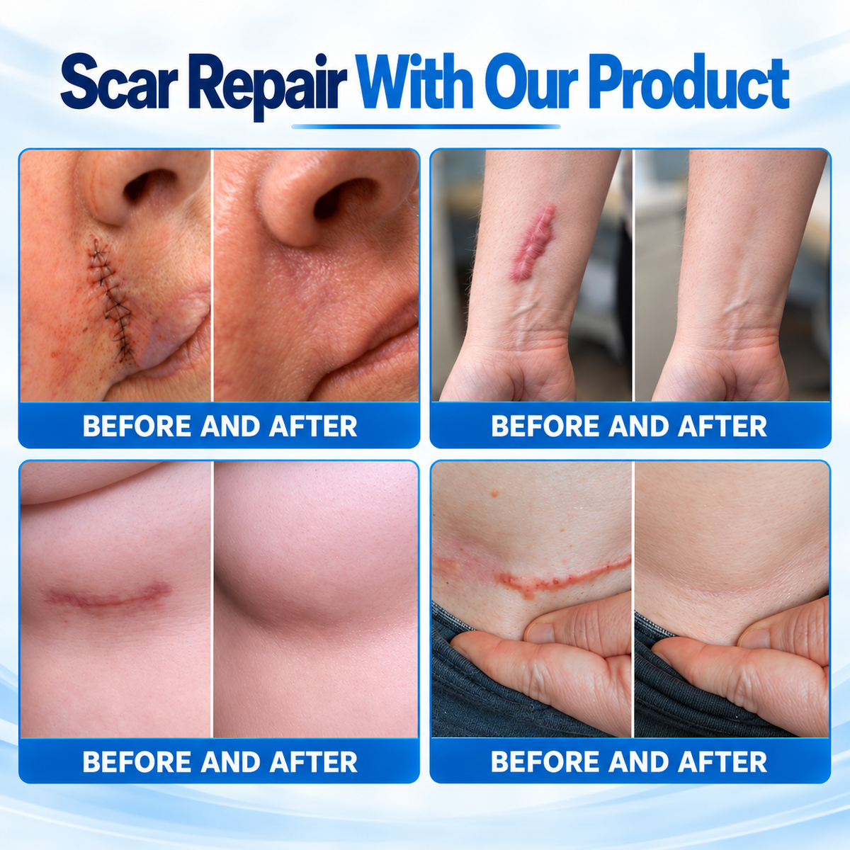 Dr.Fachmer® 👩⚕️Bio-Regenerative Micro-Needle Scar Patch –Repair Protein Silicone Scar Care for C-Section & Post-Surgical Scars