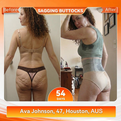 🇮🇪𝐎𝐟𝐟𝐢𝐜𝐢𝐚𝐥 𝐁𝐫𝐚𝐧𝐝 𝐒𝐭𝐨𝐫𝐞 |👙 GFOUK® 𝟐𝟎𝟐𝟔 𝐌𝐨𝐫𝐢𝐧𝐠𝐚 & 𝐁𝐞𝐫𝐛𝐞𝐫𝐢𝐧𝐞 𝟒-𝐈𝐧-𝟏 𝐌𝐢𝐜𝐫𝐨-𝐏𝐚𝐫𝐭𝐢𝐜𝐥𝐞 𝐒𝐜𝐮𝐥𝐩𝐭𝐢𝐧𝐠 & 𝐅𝐚𝐭-𝐁𝐮𝐫𝐧 𝐒𝐡𝐨𝐫𝐭𝐬
