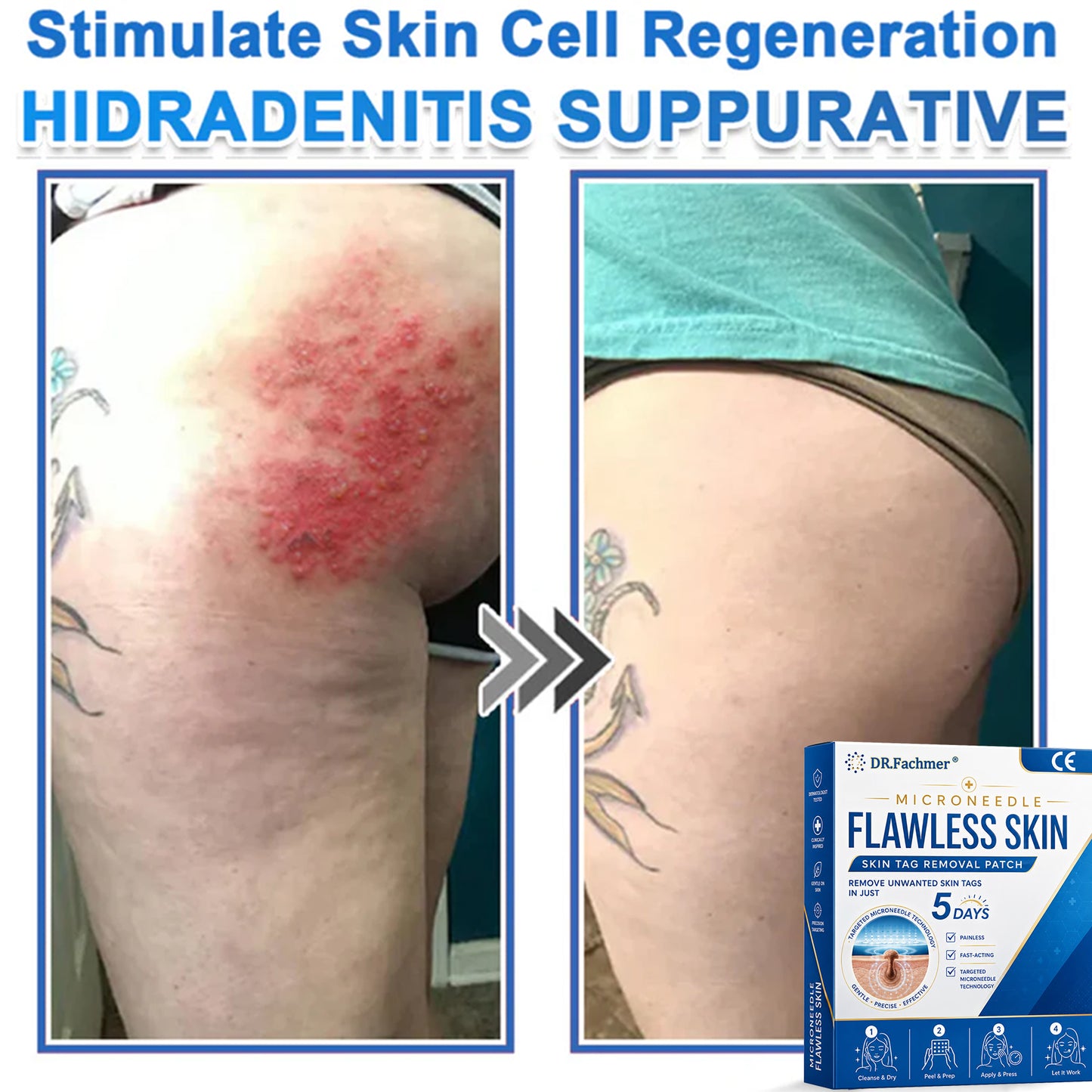 🎁🎁🎁 𝑫𝑹.𝑭𝒂𝒄𝒉𝒎𝒆𝒓® Only 10 packages left! We’re offering an additional 50% discount! Take care of your figure and your health! If you miss this opportunity now, the next one won’t be until next year. 💪