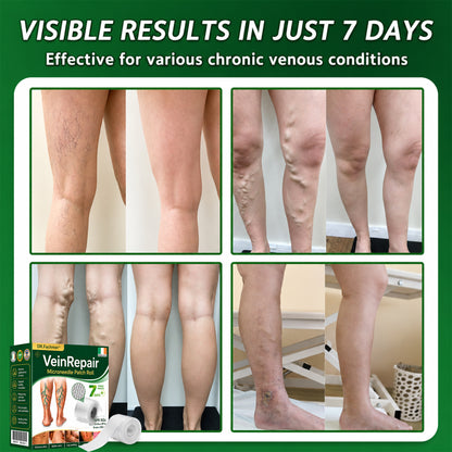 🩹DR.Fachmer® Vein Ease Microneedle Care Patch(For Spider Veins, Varicose Veins, Swelling & Leg Fatigue) - Last Day Promotion 50% OFF