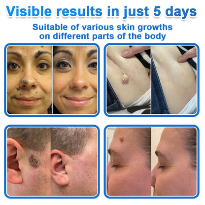 🎁🎁🎁 𝑫𝑹.𝑭𝒂𝒄𝒉𝒎𝒆𝒓® Only 10 packages left! We’re offering an additional 50% discount! Take care of your figure and your health! If you miss this opportunity now, the next one won’t be until next year. 💪