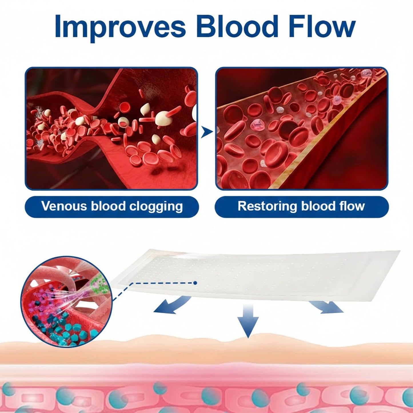 🇮🇪🍀🌳GFOUK® VeinTarget Microneedle Patch⚡Instant Relief, Long-Term Results