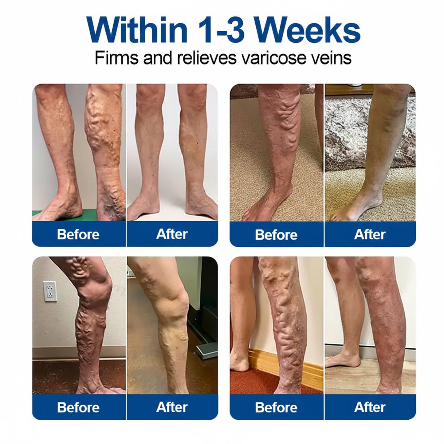 🇮🇪🍀🌳GFOUK® VeinTarget Microneedle Patch⚡Instant Relief, Long-Term Results
