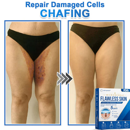 🩹 DR.Fachmer® 2-in-1 Microneedle & Hydrocolloid Patch | Raised Moles,Acne,  Flat Warts & Skin Tags Remover | Improves Wrinkles, Scars & Blemishes | Invisible Pimple Patches for Face & Body