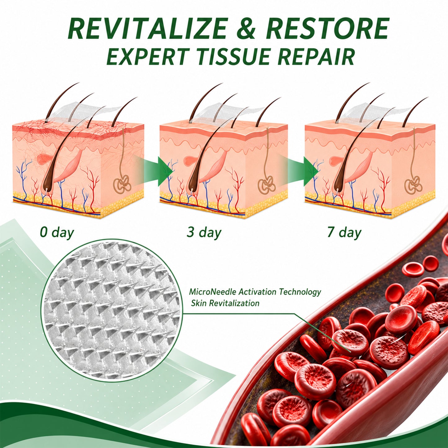 🩹DR.Fachmer® Vein Ease Microneedle Care Patch(For Spider Veins, Varicose Veins, Swelling & Leg Fatigue) - Last Day Promotion 50% OFF