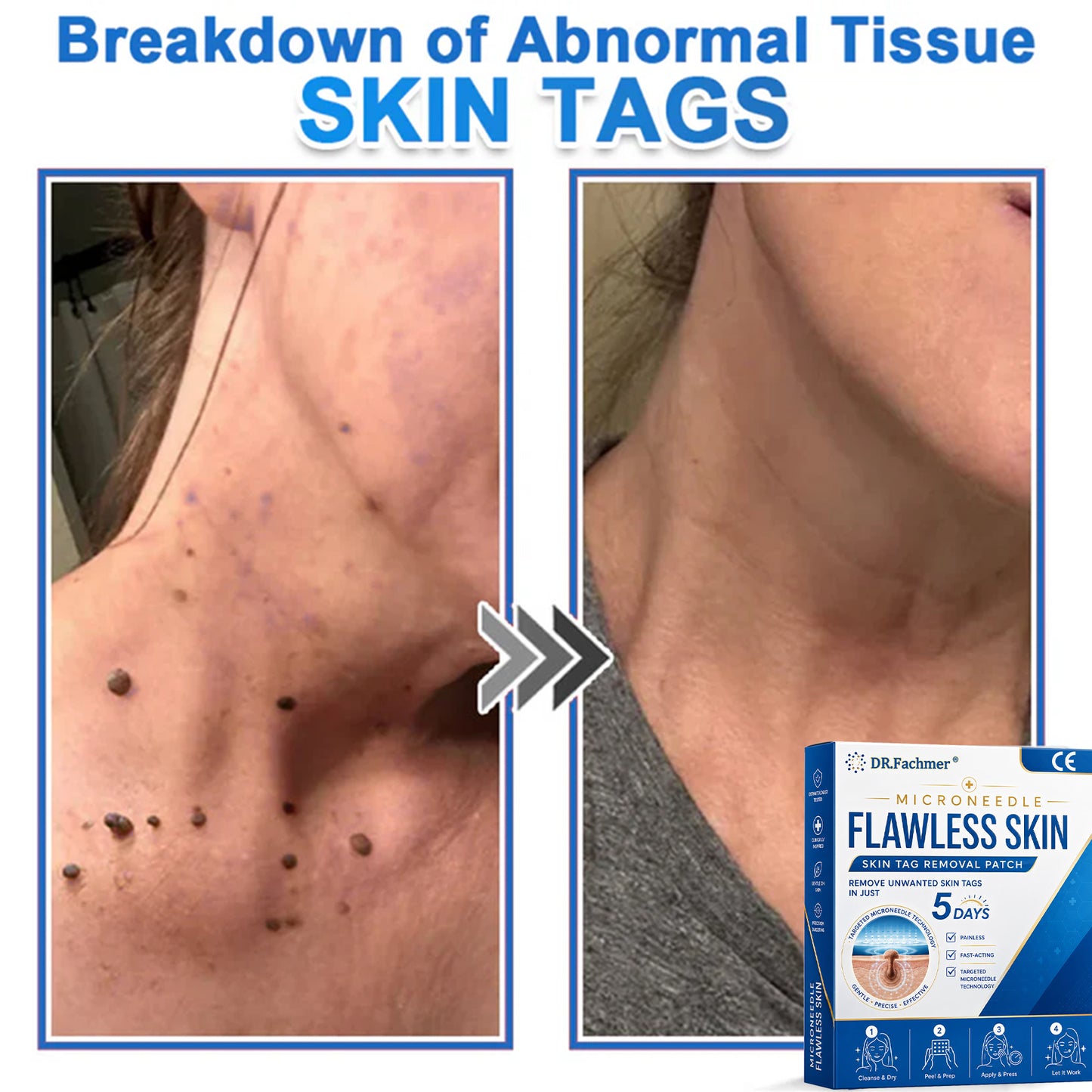 🎁🎁🎁 𝑫𝑹.𝑭𝒂𝒄𝒉𝒎𝒆𝒓® Only 10 packages left! We’re offering an additional 50% discount! Take care of your figure and your health! If you miss this opportunity now, the next one won’t be until next year. 💪