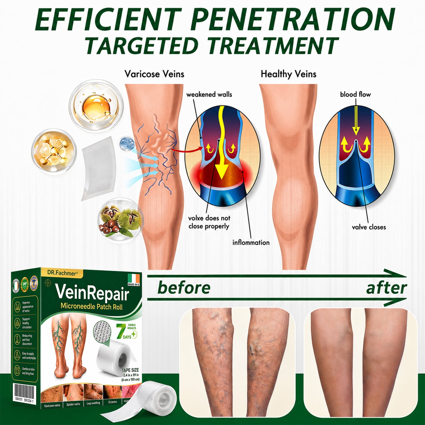 🩹DR.Fachmer® Vein Ease Microneedle Care Patch(For Spider Veins, Varicose Veins, Swelling & Leg Fatigue) - Last Day Promotion 50% OFF