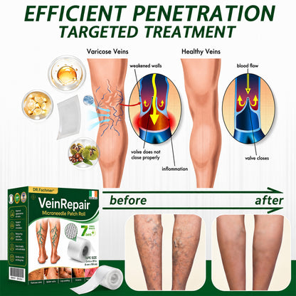 🩹DR.Fachmer® Vein Ease Microneedle Care Patch(For Spider Veins, Varicose Veins, Swelling & Leg Fatigue) - Last Day Promotion 50% OFF