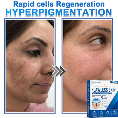 🩹 DR.Fachmer® 2-in-1 Microneedle & Hydrocolloid Patch | Raised Moles,Acne,  Flat Warts & Skin Tags Remover | Improves Wrinkles, Scars & Blemishes | Invisible Pimple Patches for Face & Body